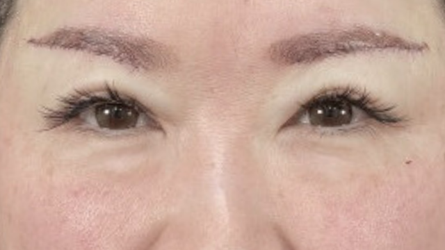 Postoperative Condition Part 1