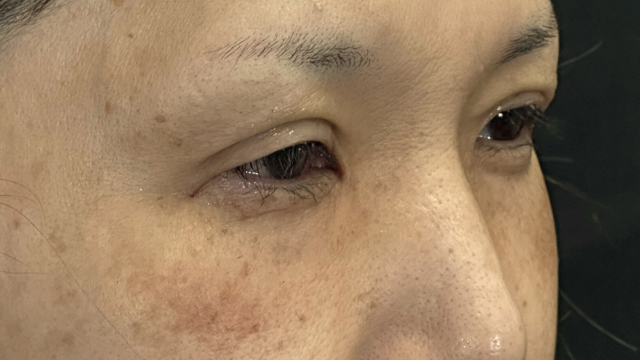 Postoperative Condition Part 1