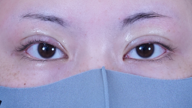 Postoperative Condition Part 1