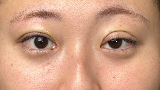 Postoperative Condition Part 1