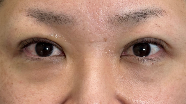 Postoperative Condition Part 1