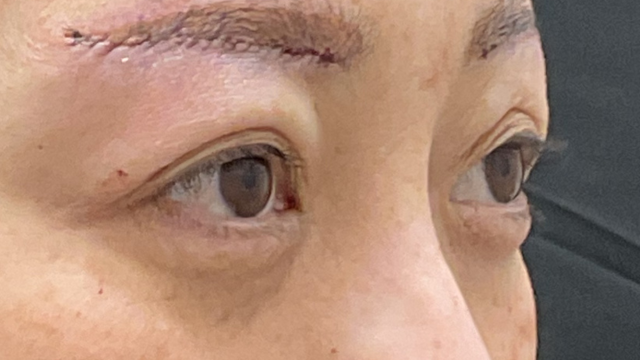 Postoperative Condition Part 1