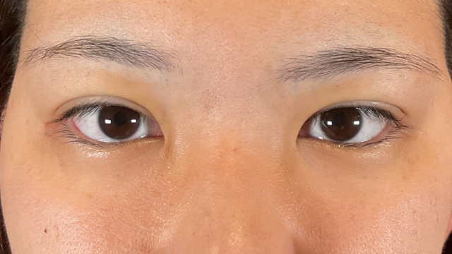 Postoperative Condition Part 1