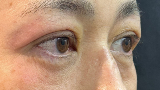 Postoperative Condition Part 1