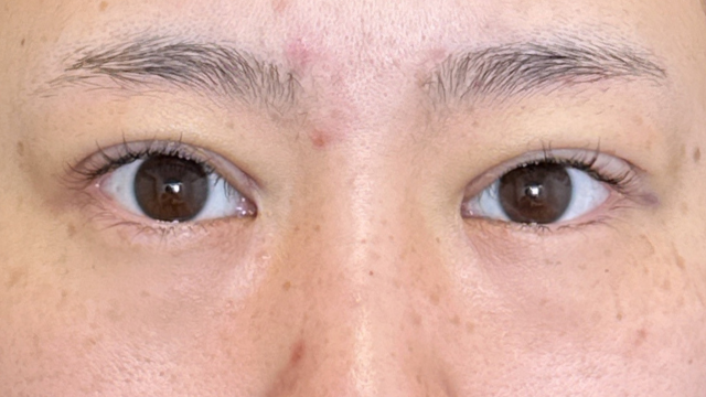 Postoperative Condition Part 1