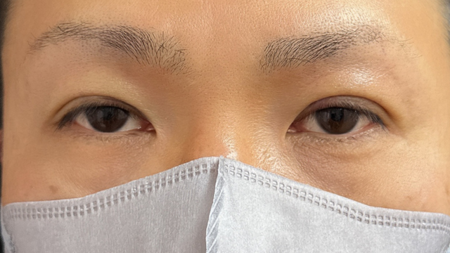 Postoperative Condition Part 1