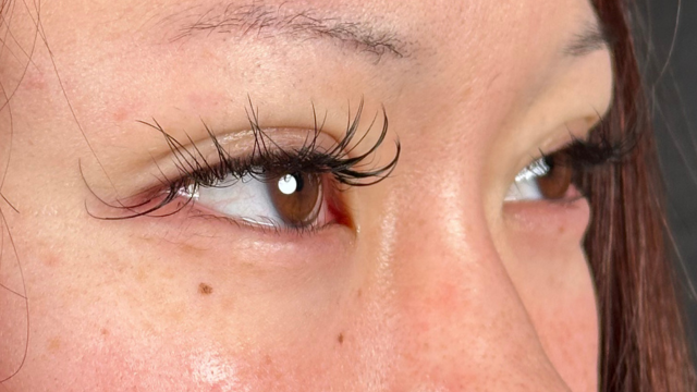 Postoperative Condition Part 1