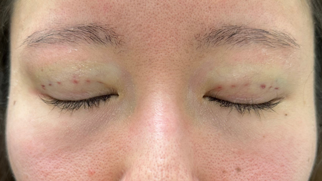 Postoperative Condition Part 1