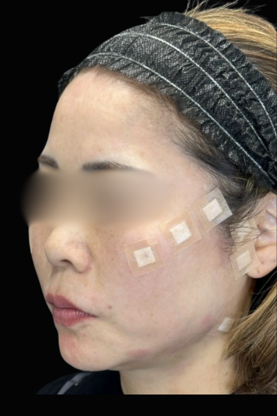 Postoperative Condition Part 1