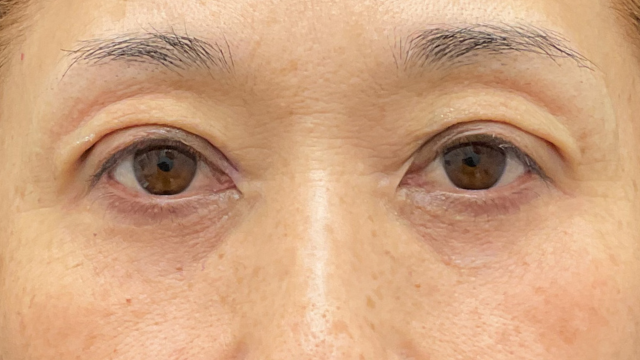 Postoperative Condition Part 1