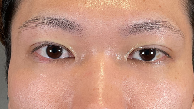 Postoperative Condition Part 1