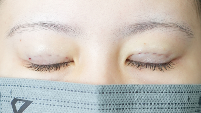 Postoperative Condition Part 1