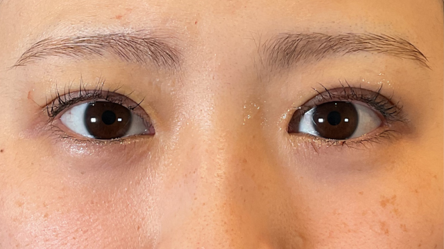 Postoperative Condition Part 1