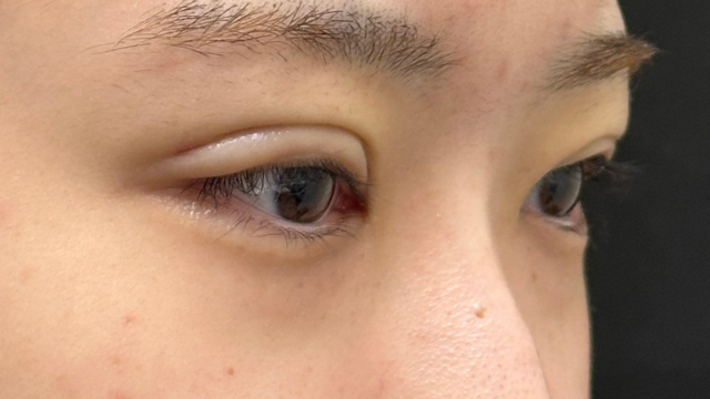 Postoperative Condition Part 1