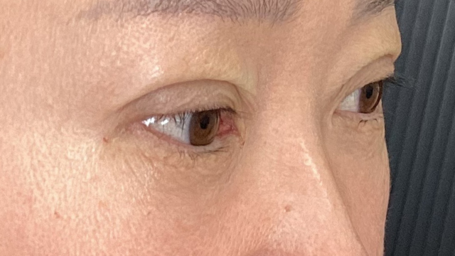 Postoperative Condition Part 1