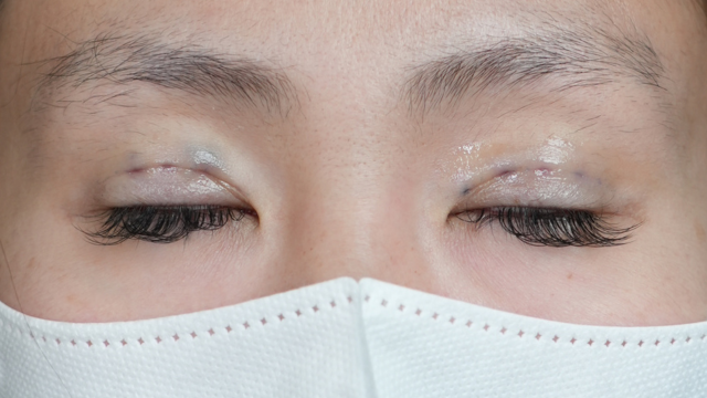 Postoperative Condition Part 1