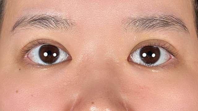 Postoperative Condition Part 1