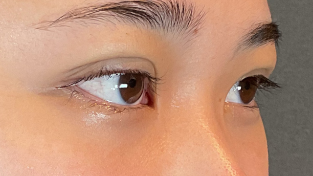 Postoperative Condition Part 1