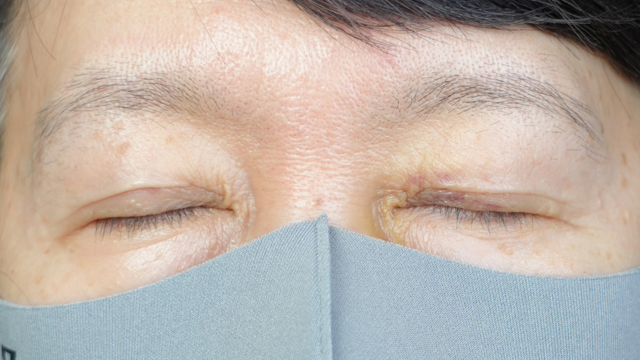 Postoperative Condition Part 1