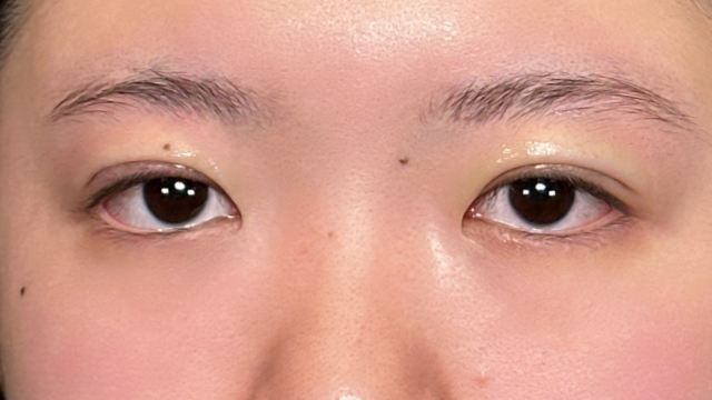 Postoperative Condition Part 1