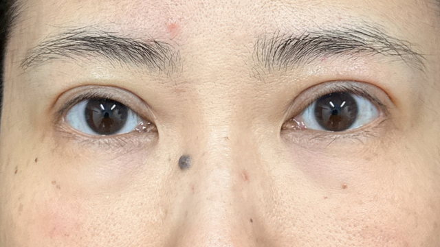 Postoperative Condition Part 1