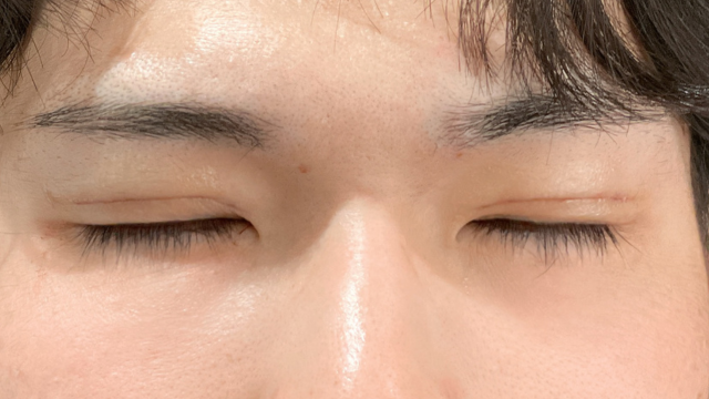 Postoperative Condition Part 1