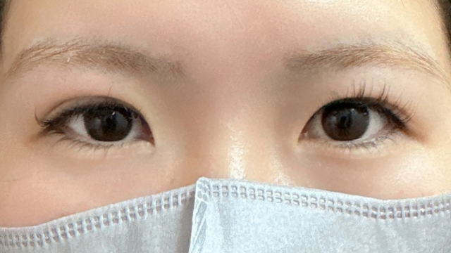 Postoperative Condition Part 1