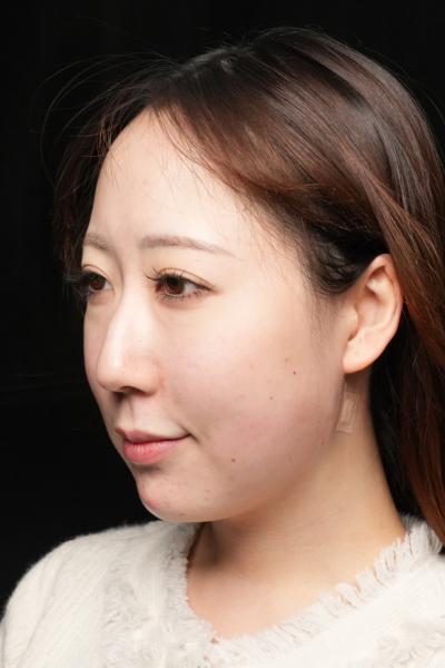 Postoperative Condition Part 1