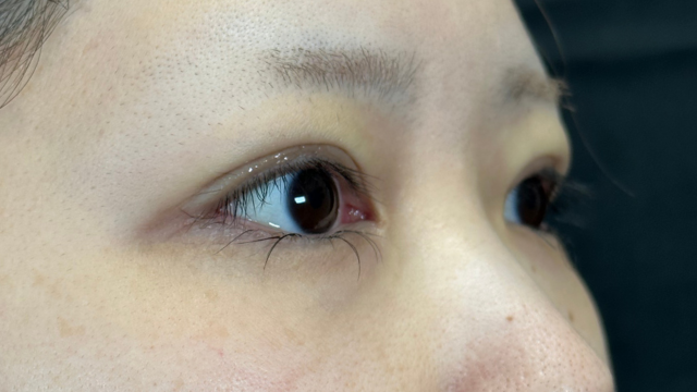 Postoperative Condition Part 1