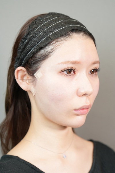 Postoperative Condition Part 1