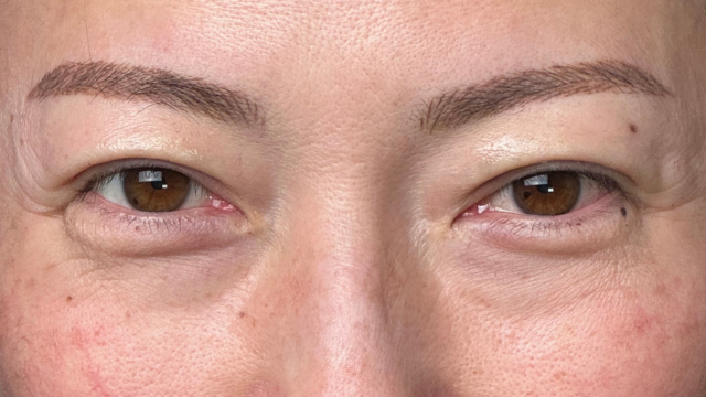 Postoperative Condition Part 1