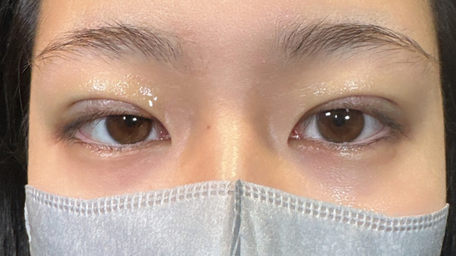 Postoperative Condition Part 1