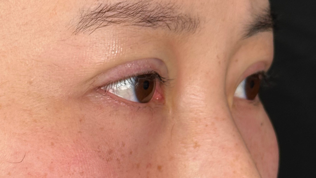 Postoperative Condition Part 1