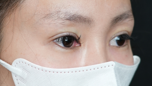 Postoperative Condition Part 1