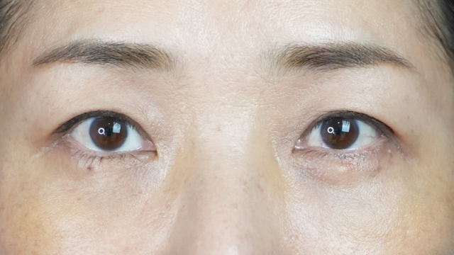 Postoperative Condition Part 1