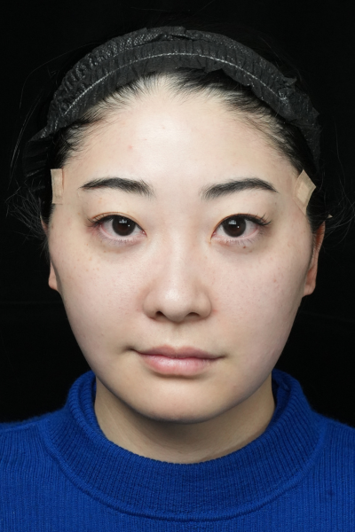 Postoperative Condition Part 1