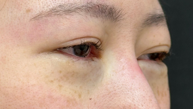 Postoperative Condition Part 1