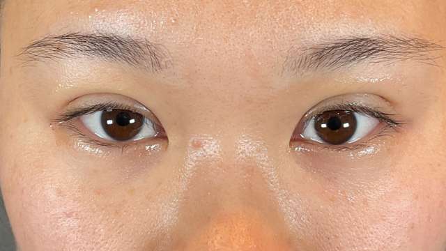 Postoperative Condition Part 1