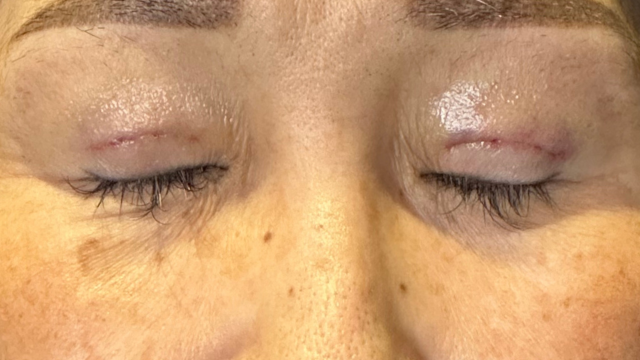 Postoperative Condition Part 1