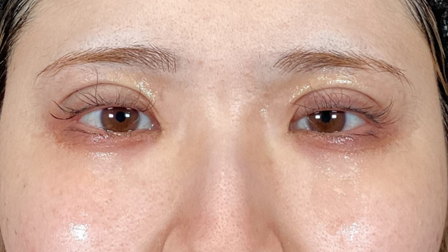 Postoperative Condition Part 1