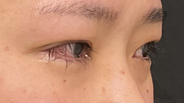 Postoperative Condition Part 1