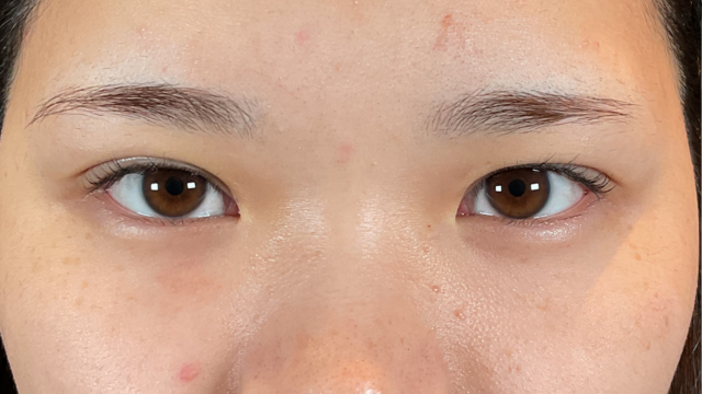 Postoperative Condition Part 1