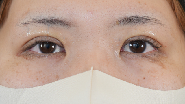 Postoperative Condition Part 1