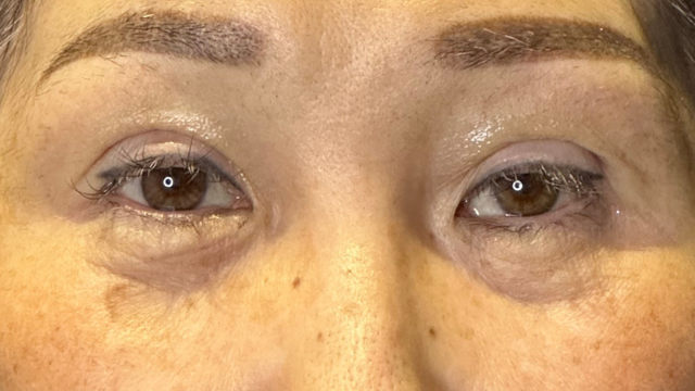 Postoperative Condition Part 1