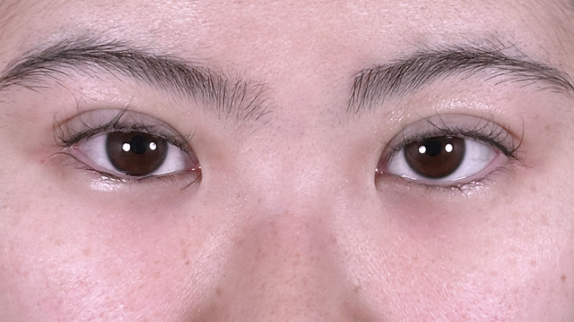 Postoperative Condition Part 1