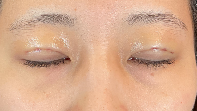 Postoperative Condition Part 1