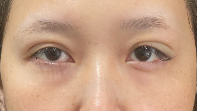 Postoperative Condition Part 1