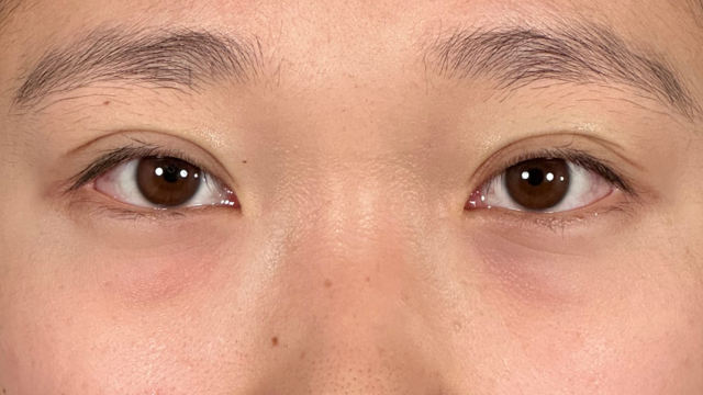 Postoperative Condition Part 1