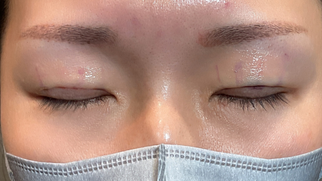 Postoperative Condition Part 1