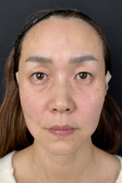 Postoperative Condition Part 1